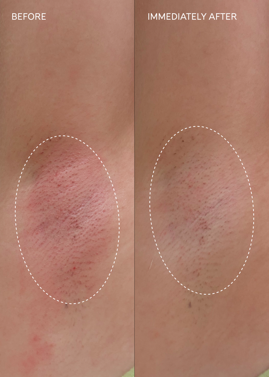 Fur Flash Repair Jelly